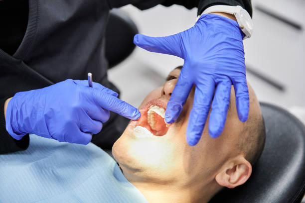 Best Emergency Root Canal Treatment in Jersey City, NJ